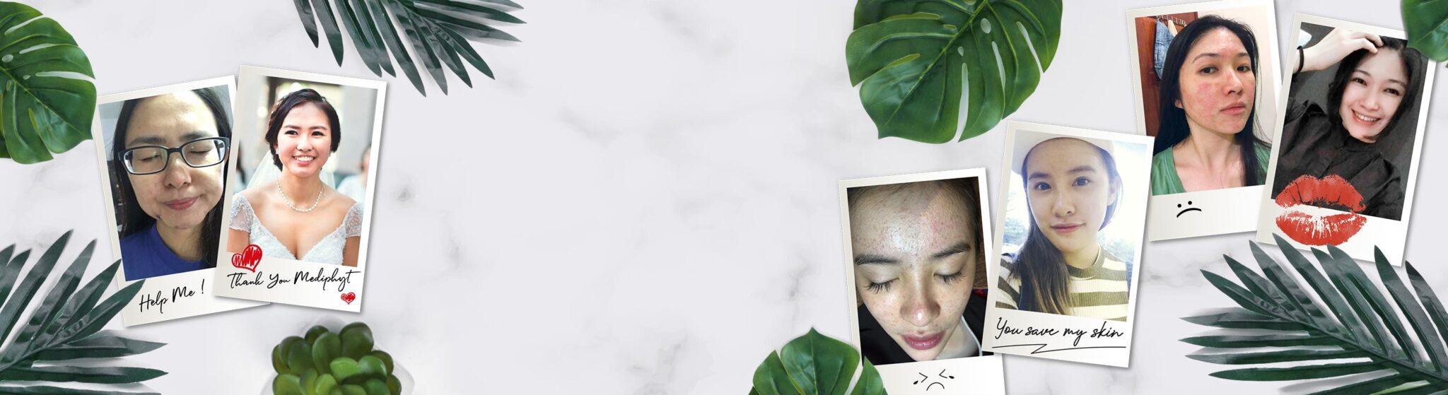 Skin-Transformation-4-1 Skin-Transformation-4-1
